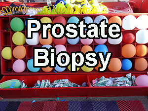 Prostate Biopsy, MRI, PSA, and Prostate Cancer
